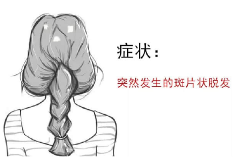 v2-37cfbd7005bb3ee8565a2198045f3b1c_r.jpg