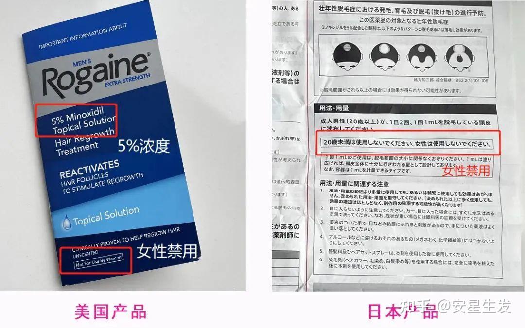 米诺地尔浓度怎么选？男女都可以用米诺地尔吗？ - 知乎