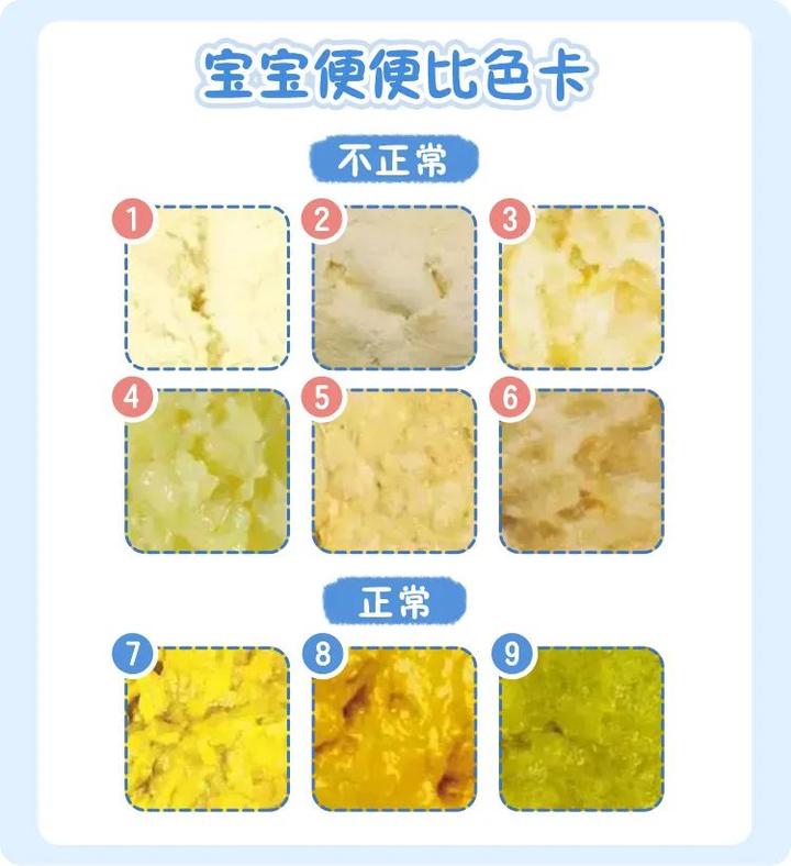 托幼教师一图了解——宝宝便便图谱大全 - 知乎