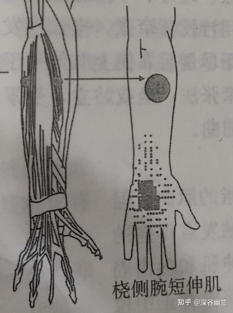 讀書筆記肱橈肌和腕伸肌觸發點