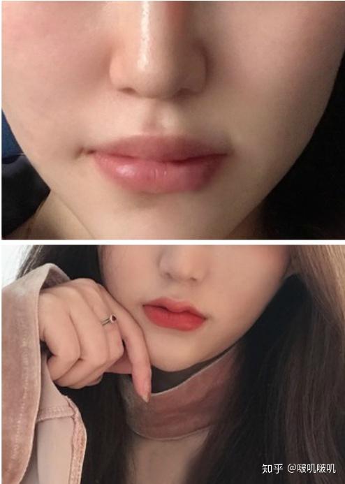 成都做嘴巴m唇哪里好