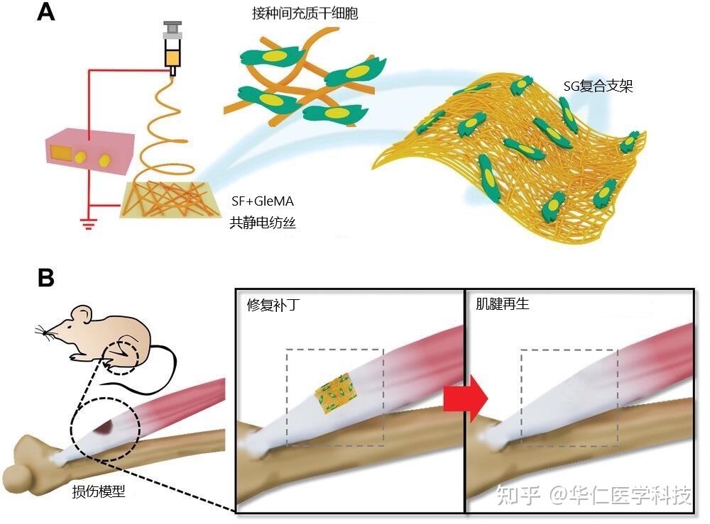 间充质干细胞结合丝素蛋白生物支架肌腱修复新希望