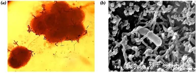 认识两歧双歧杆菌(Bifidobacterium bifidum)及其健康益处 - 知乎