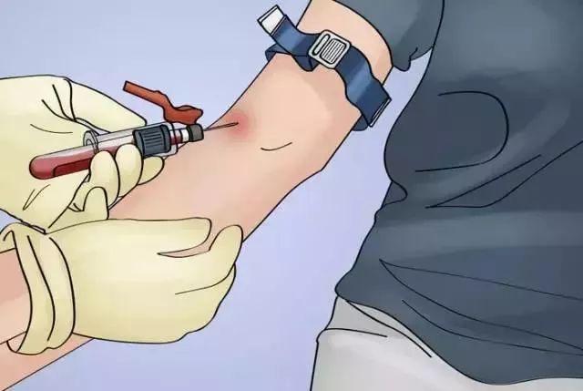 护士注意静脉采血最新国家标准发布