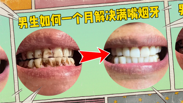 男生烟牙齿怎么变白,去烟渍,就学这2招就行了!口气还变清新