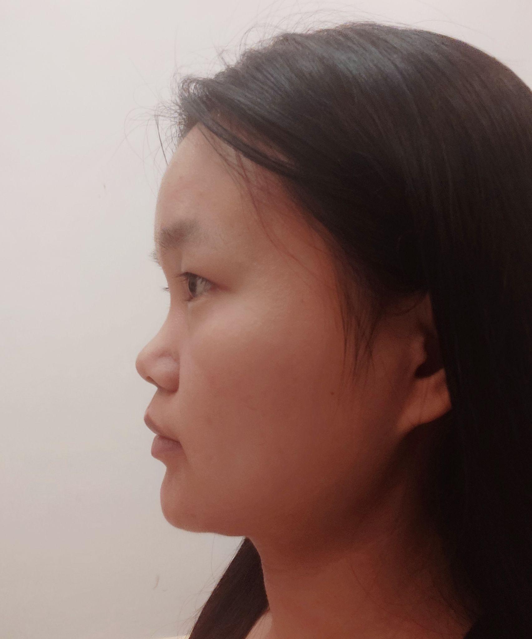 没有山根是种什么体验