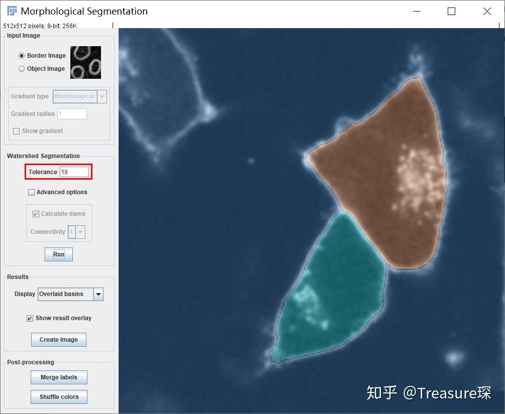 ImageJ实用教程——细胞膜荧光强度检测(定量分析篇) | 斯博利康-细胞生物学液体试剂专家