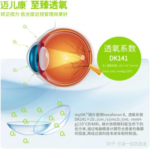 详细带你了解OK镜是什么？品牌又该怎么去选择？ - 知乎