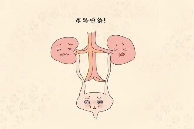 女性尿路感染能自愈吗?