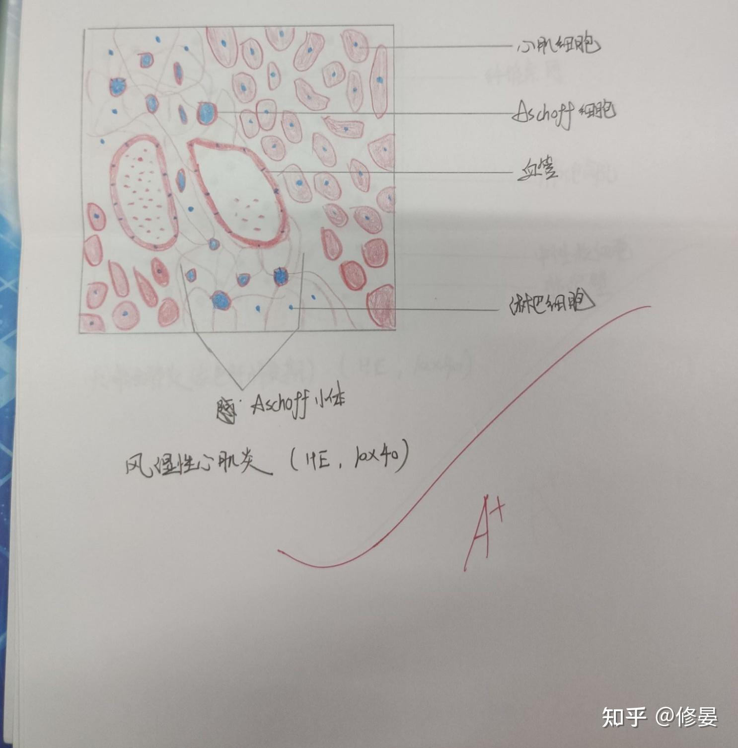 病理切片红蓝铅笔绘图