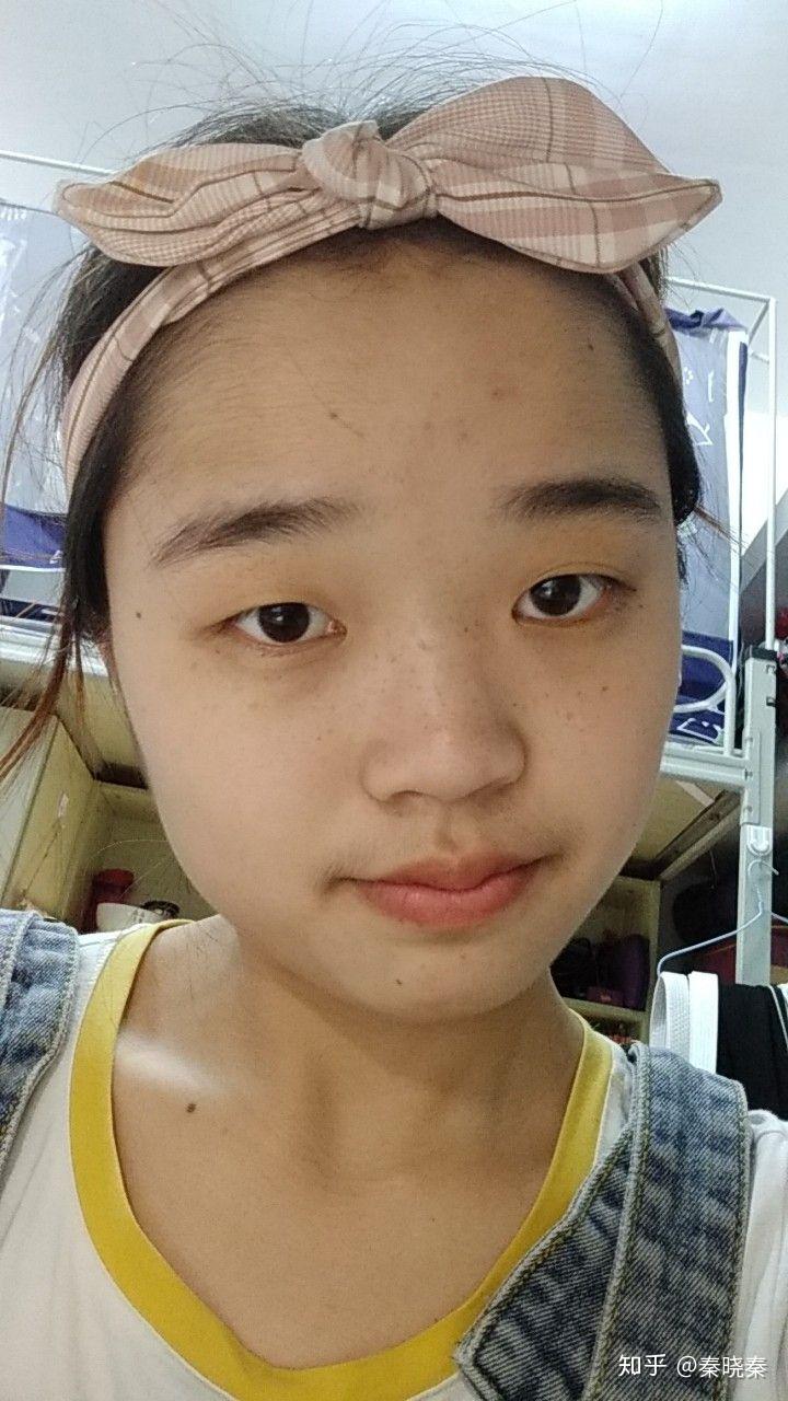 没有鼻梁鼻子塌的人是什么体验