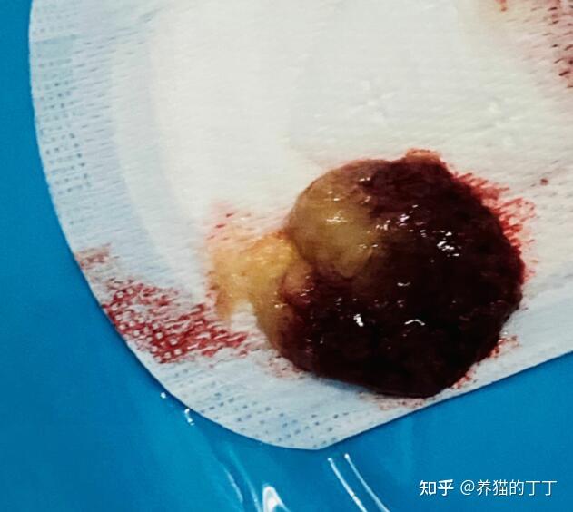 自己痛的时候流下了的东西还以为就是像月经一样的子宫内膜脱落事件二