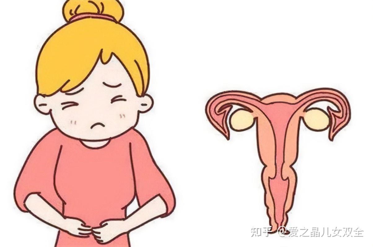 子宫内膜异位症对IVF结局的影响 - 知乎