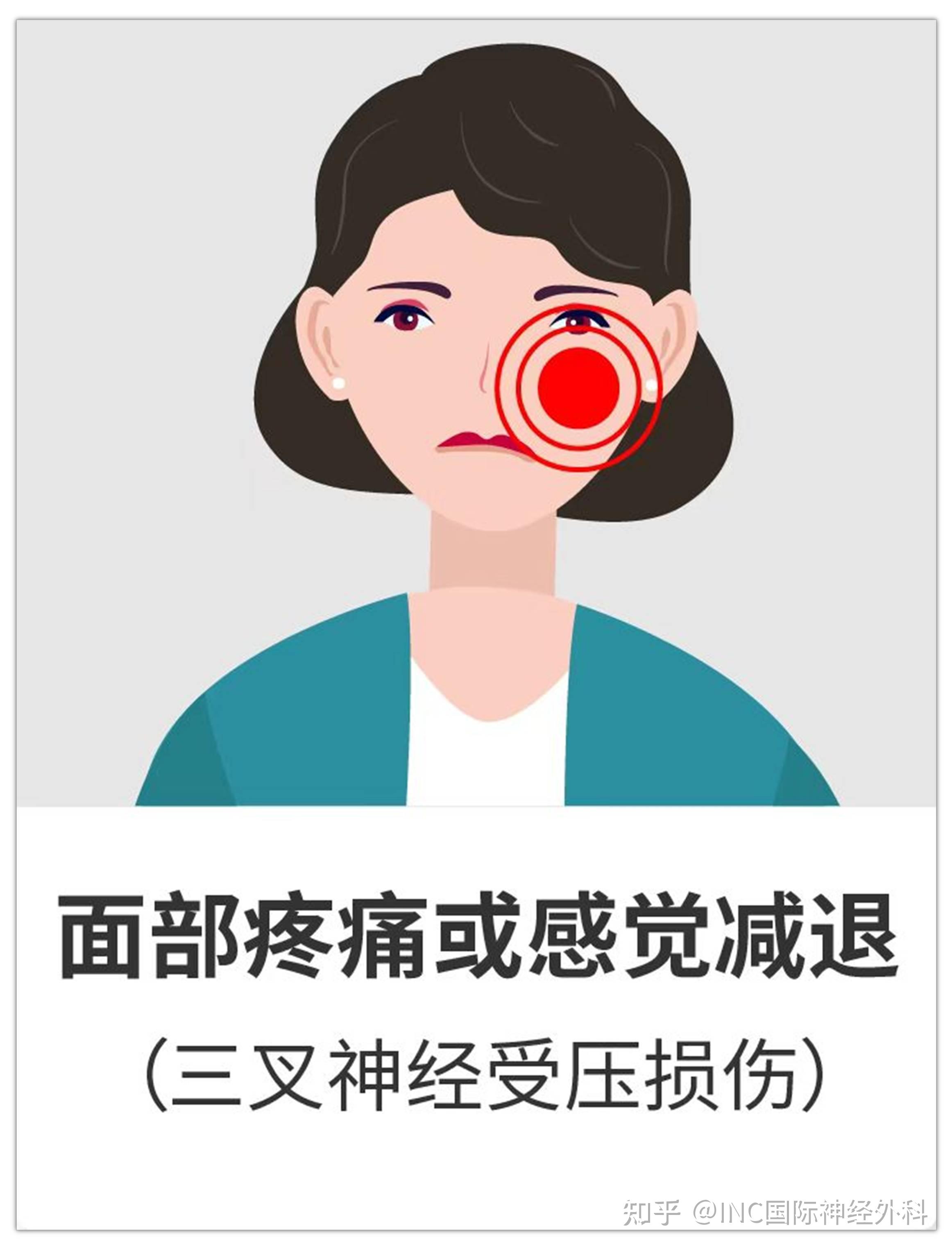 面部疼痛或感觉减退【三叉神经受压迫损伤】