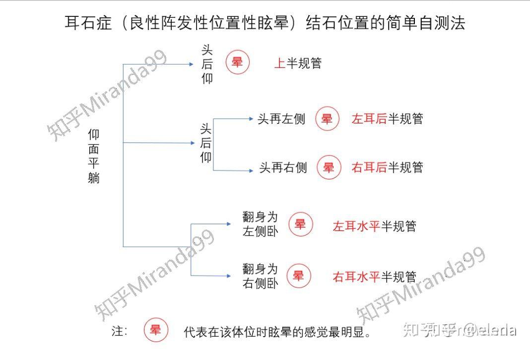 耳石症的自愈