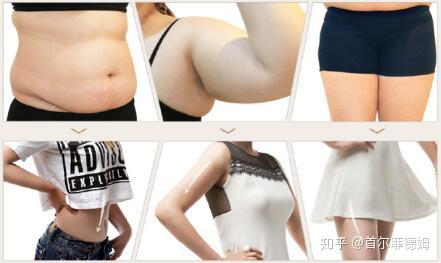 啥是吸脂 v2-3934ab5ff7f442524072308a2d522dbc_r.jpg