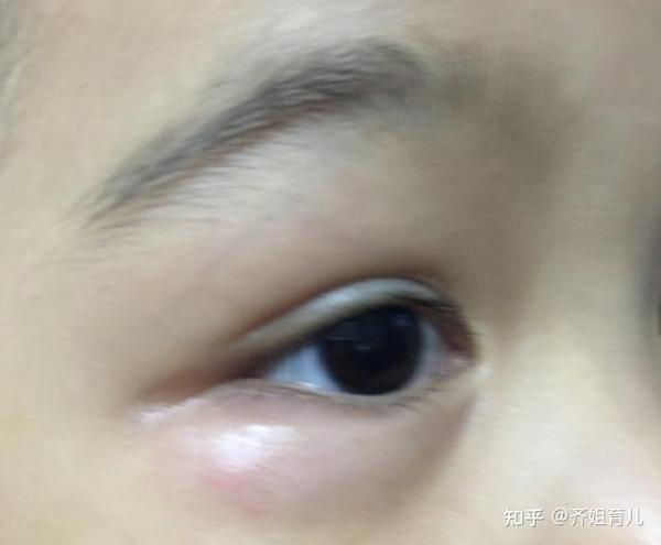 孩子眼睛有这3个变化 多半是脾胃出问题了 父母仔细观察别忽视 知乎