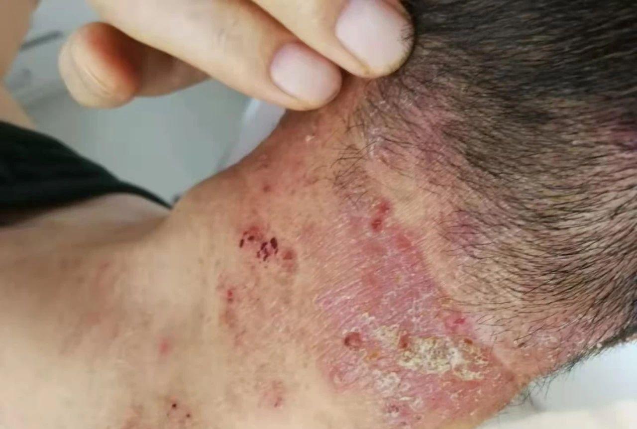 西芹汁体验案例小学霸疗愈增强眼睛视力大叔疗愈紫外线过敏