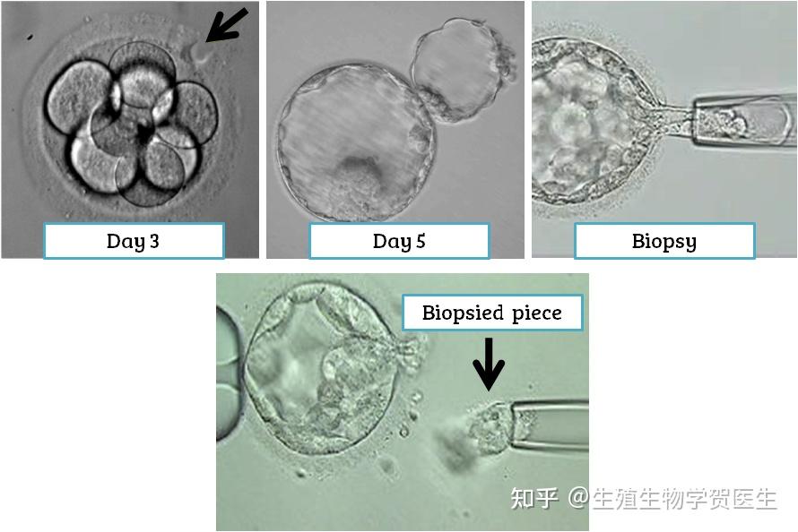 Pgtesting PGS 测试完整指南 (PGT-A) - 知乎