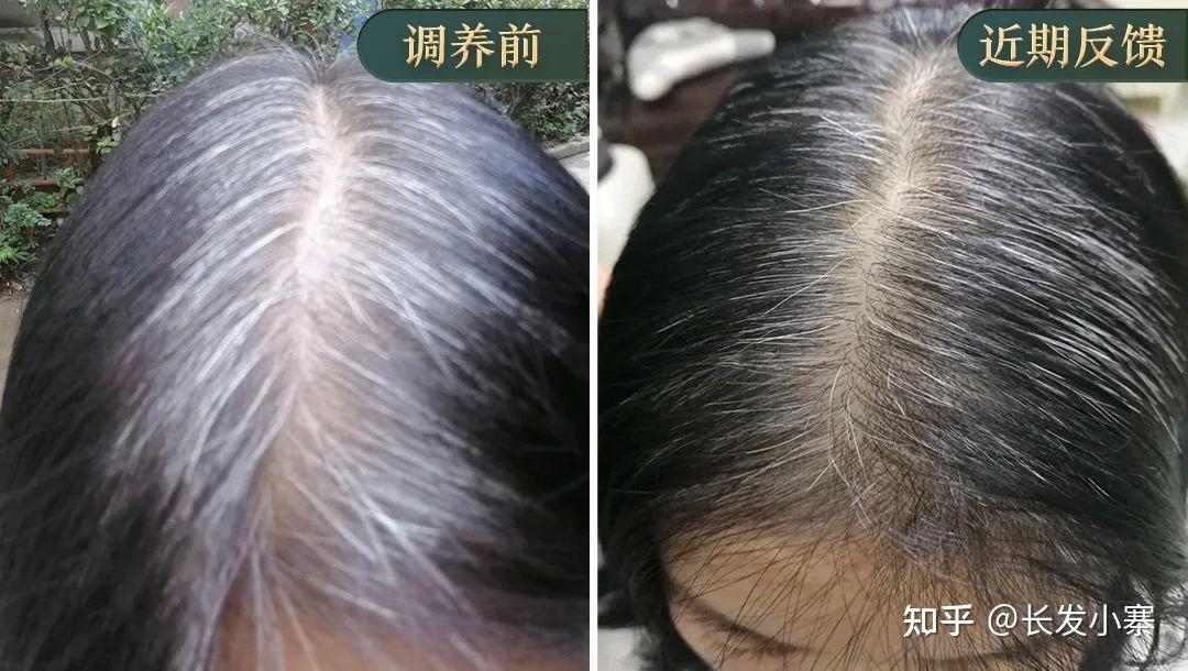 长发小寨给白发者的一封信 - 知乎