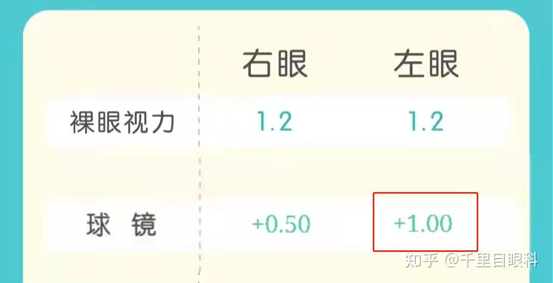 左右眼屈光球镜对照表图片