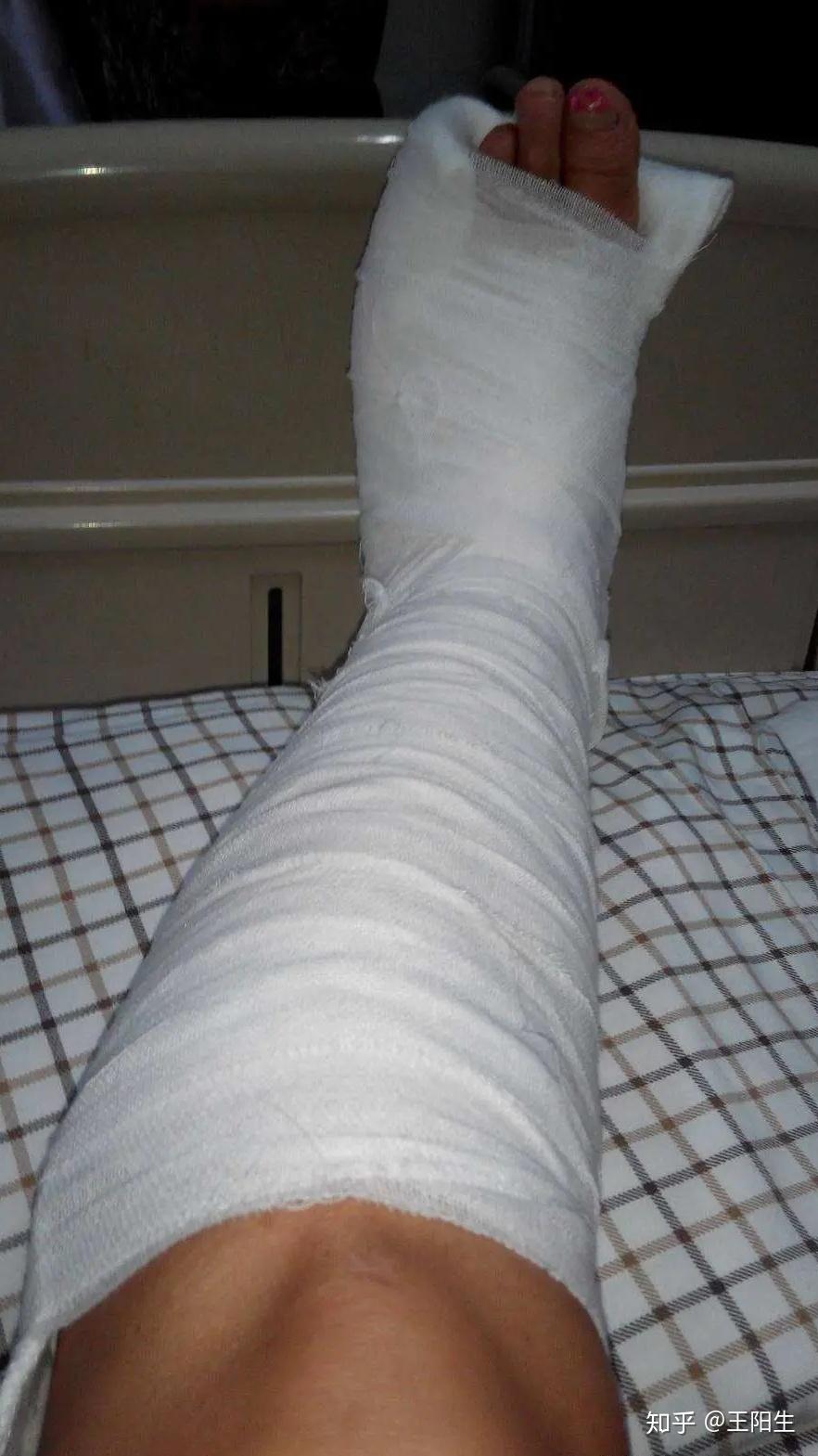 罗大伦老师骨折病人家传食疗方