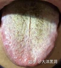 v2-39a920c054c696bec9fab4fd4dce2790_b.jpg