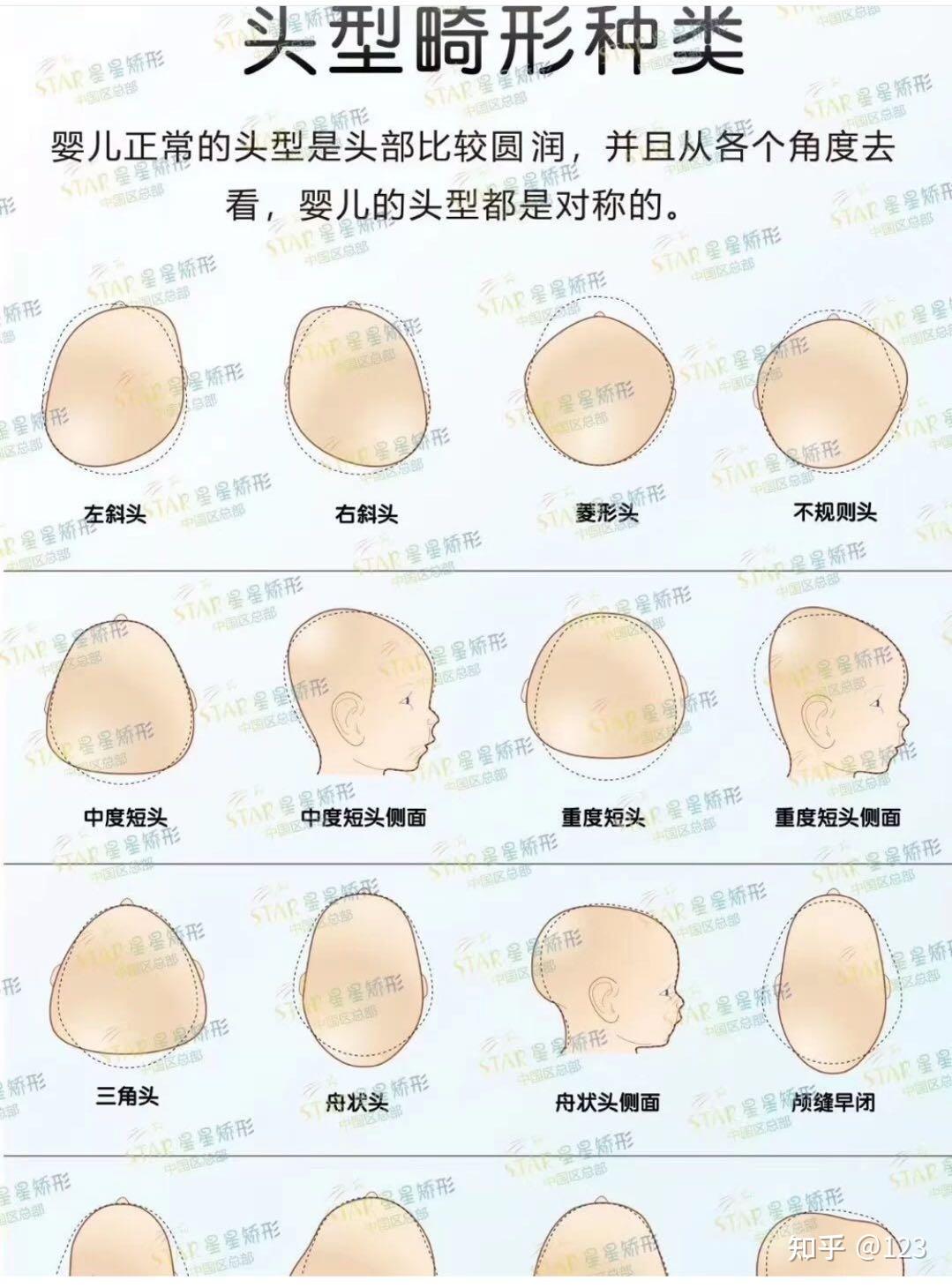 您家宝宝属于哪种头型呢