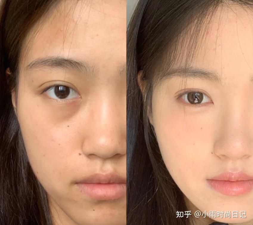 关于垮脸恢复我的5点总结 - 知乎