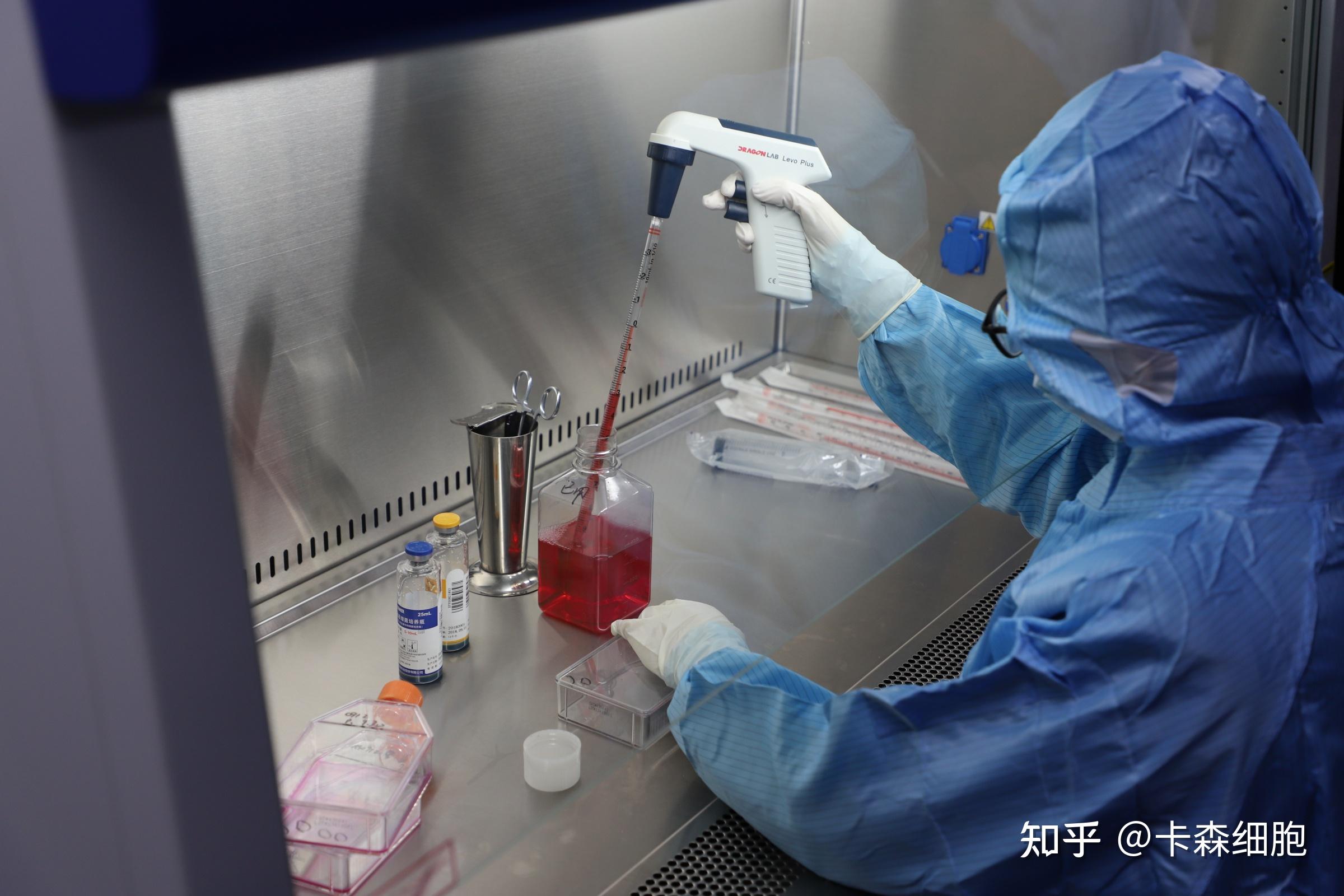 脐带间充质干细胞治疗系统性红斑狼疮