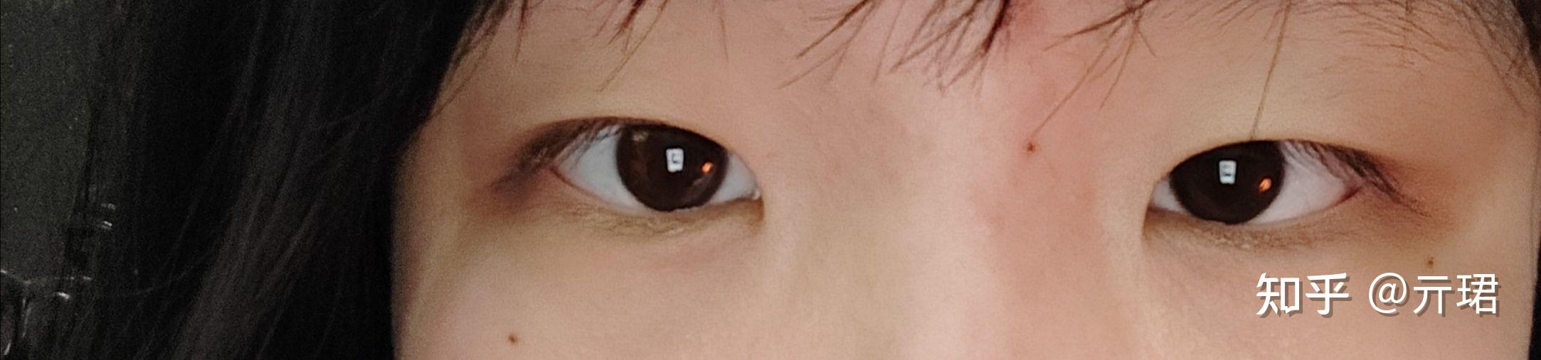有眼尾沟的眼睛好看吗