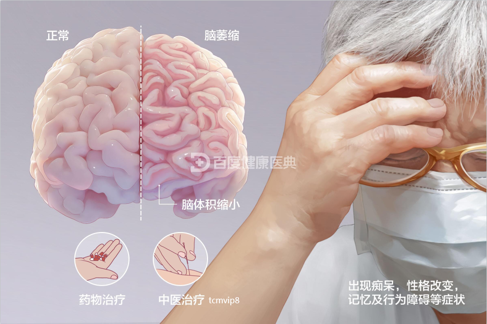 小脑萎缩中医是怎么治疗的