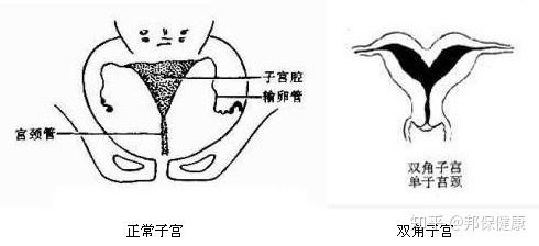 v2-3a68738556a42296d664f5a0d21fc48c_r.jpg