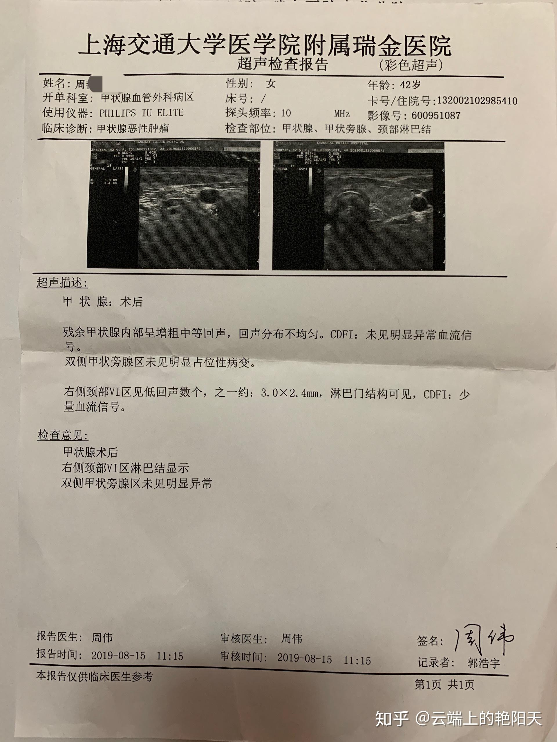 如何评价上海瑞金医院普外科医生邱伟华?