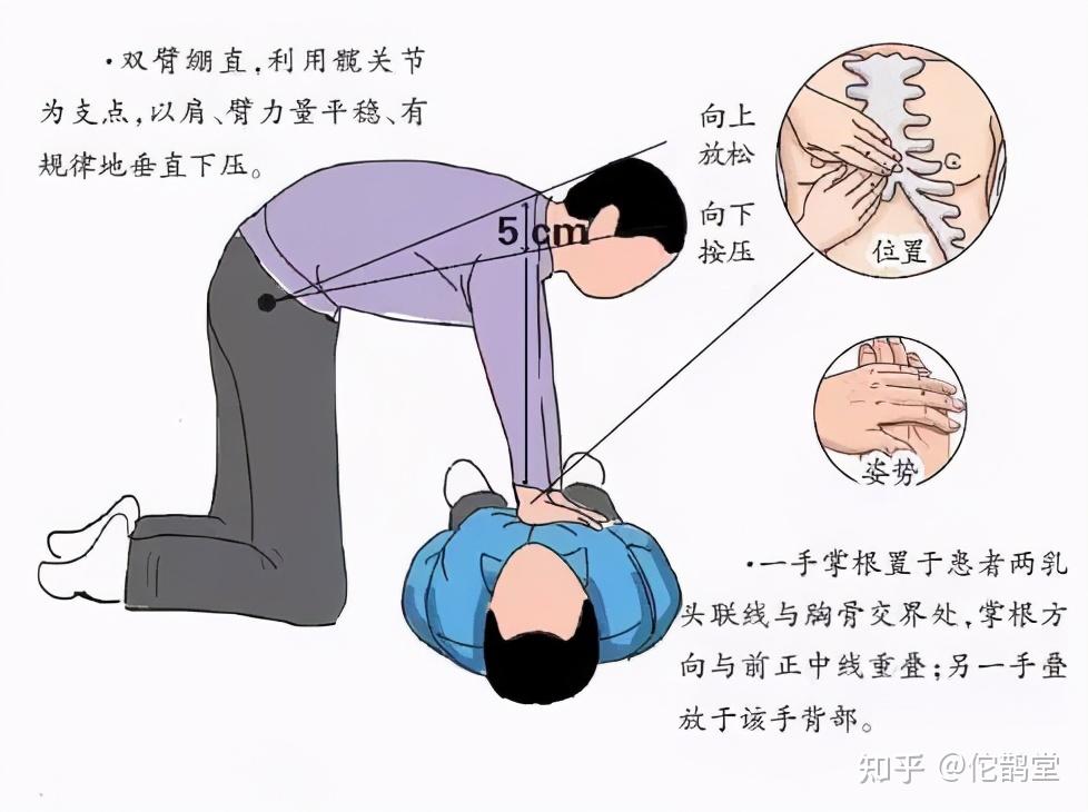 知名急救专家突发脑梗