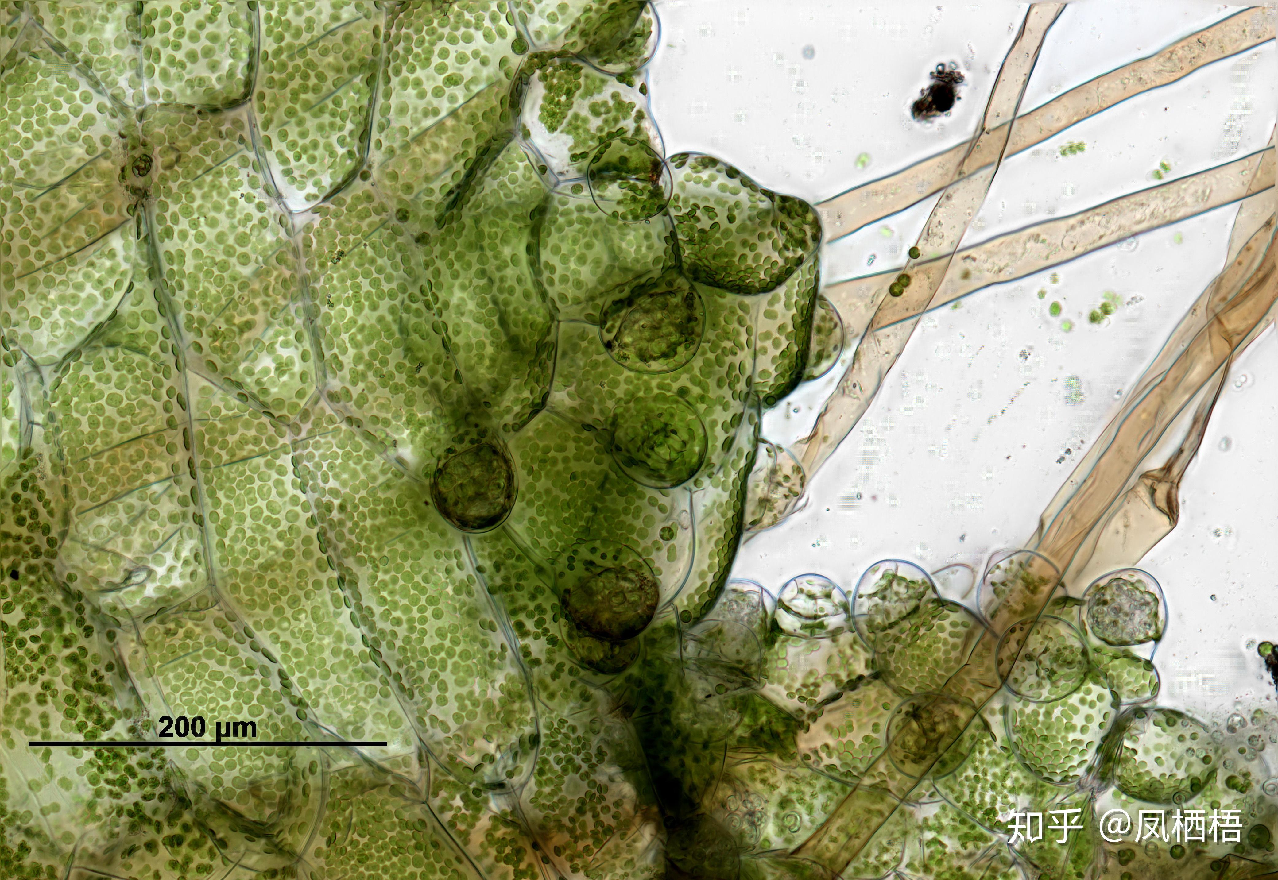 这是蕨类的孢子为什么在十倍镜下像是一串葡萄是多个孢子的聚合体