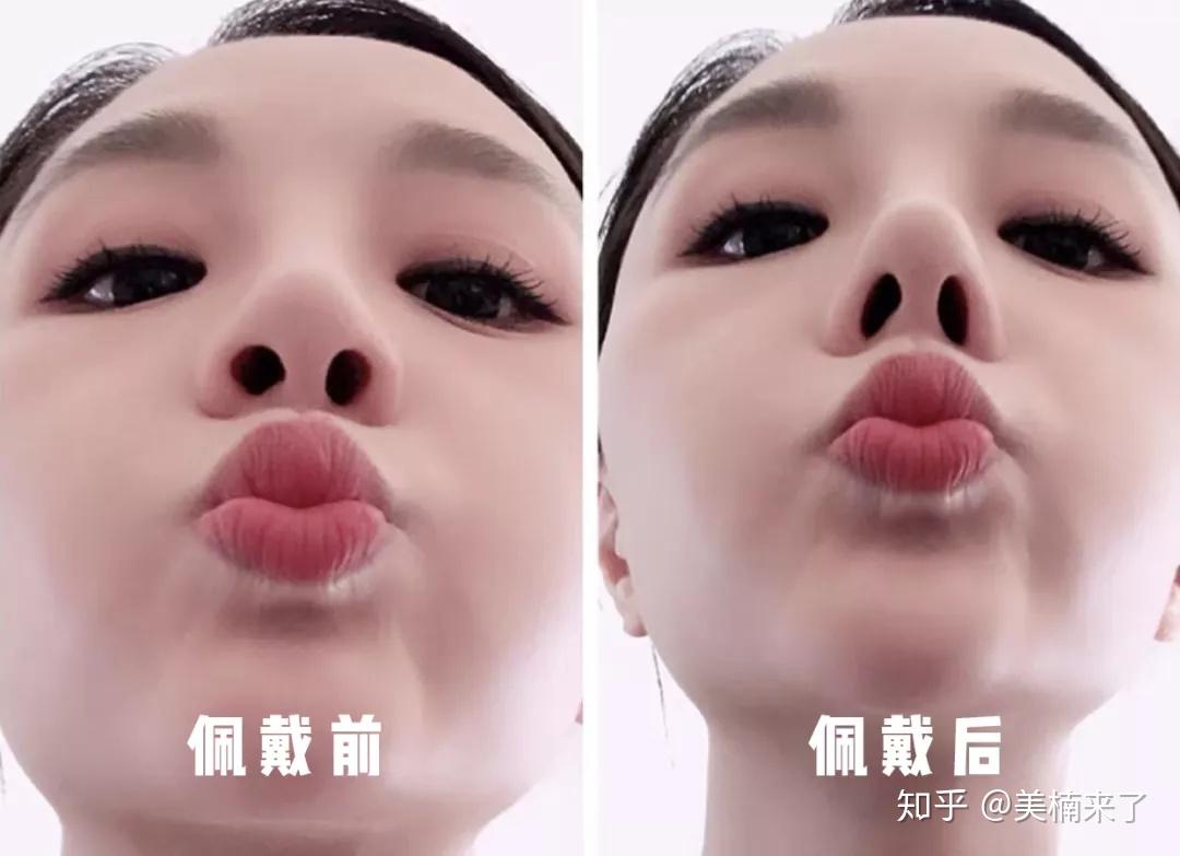 好多妹子都说自己天天敲山根捏鼻梁之后鼻子变挺了这真的不是做梦么