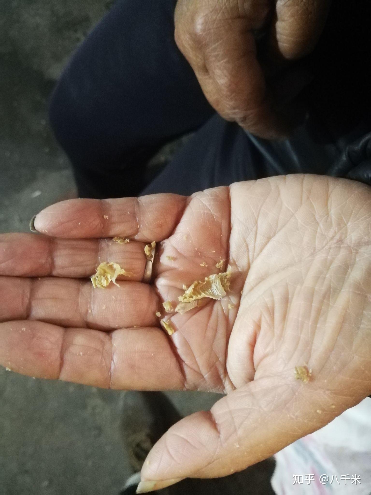 耳屎最大能有多大