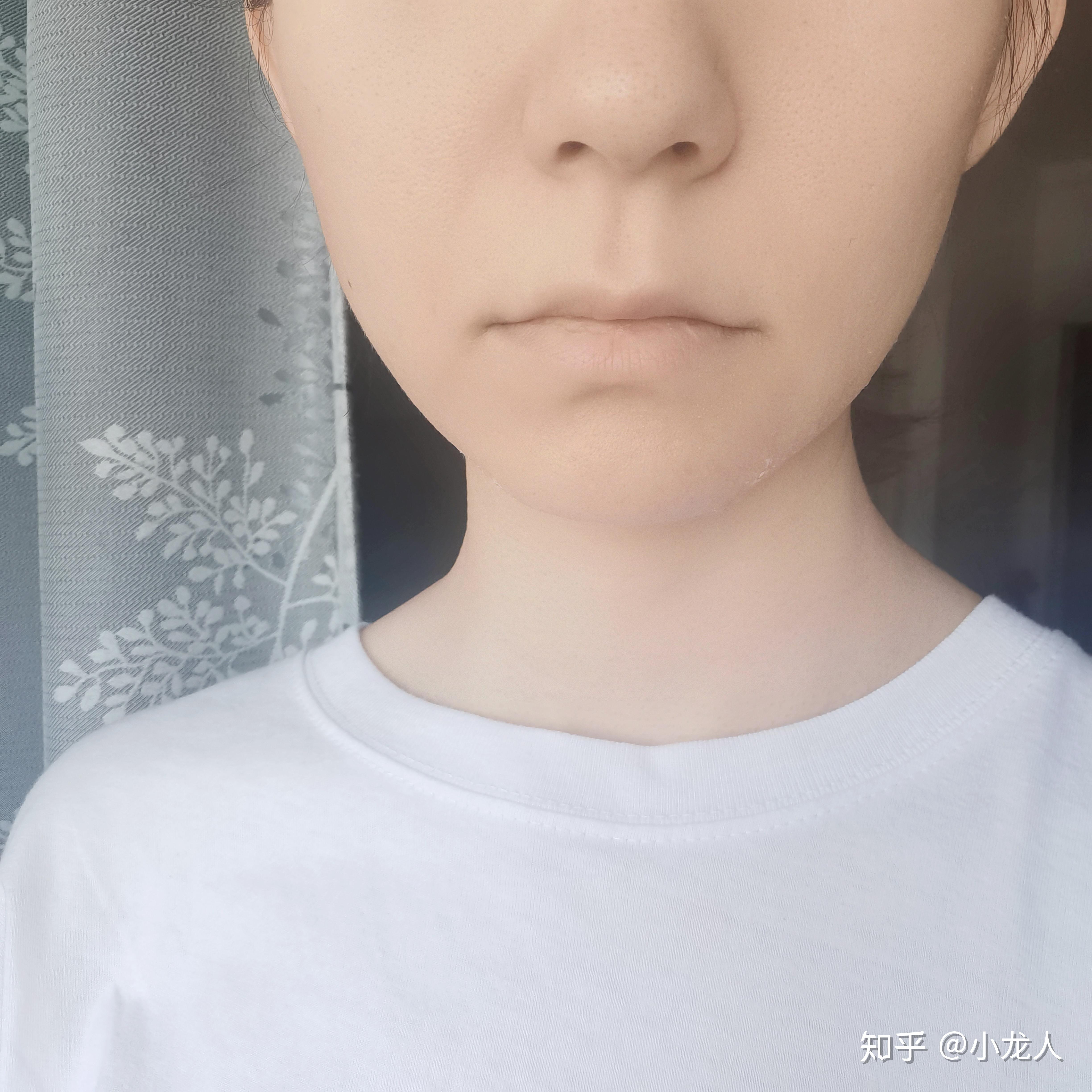 我的嘴唇很白,没有一点血色.可是又不贫血是为什么? - 知乎