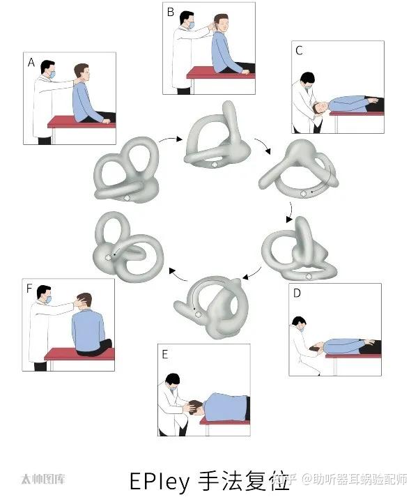 耳石症怎么检查图片