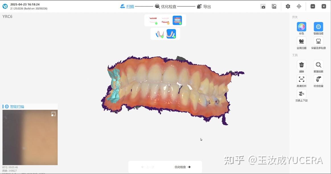 临床医生必看:为什么你的口扫数据总被技工所退回?有效口扫数据获取的三大关键点,避免返工! - 知乎