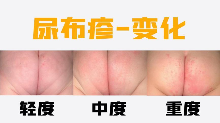 宝妈们有什么好的建议吗?