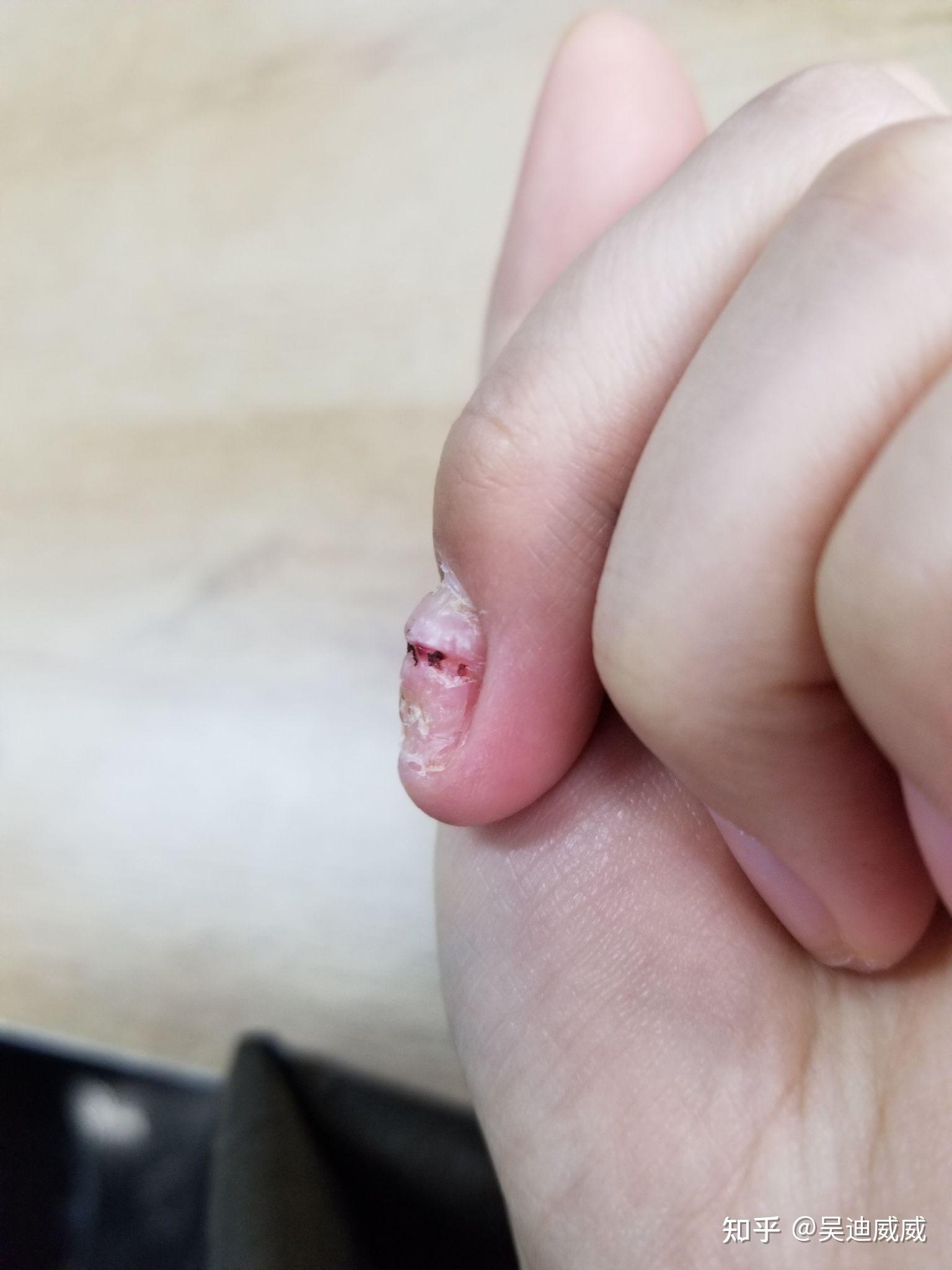 被门夹到手是一种什么体验? - 知乎