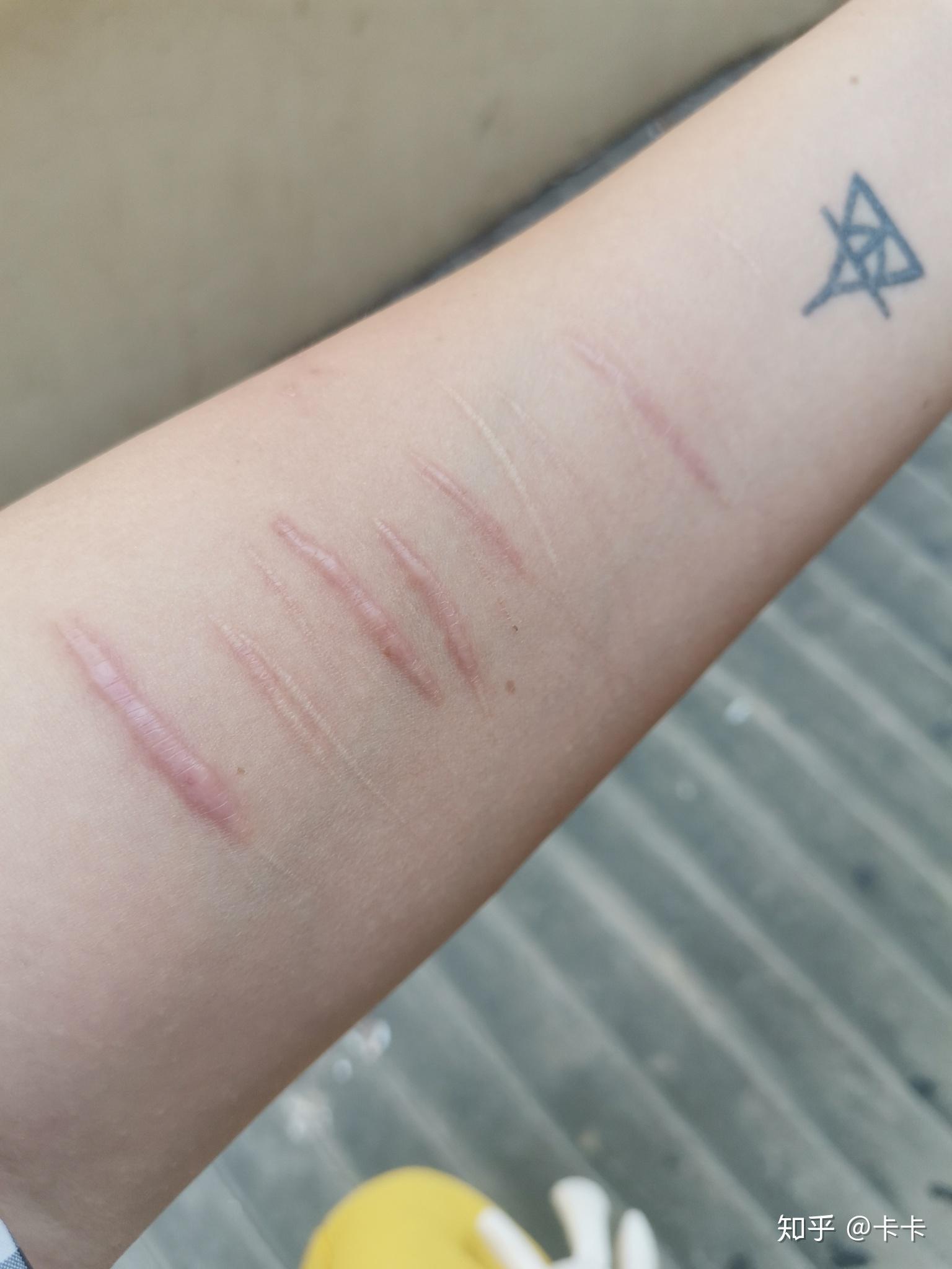 怎么遮自残的伤疤