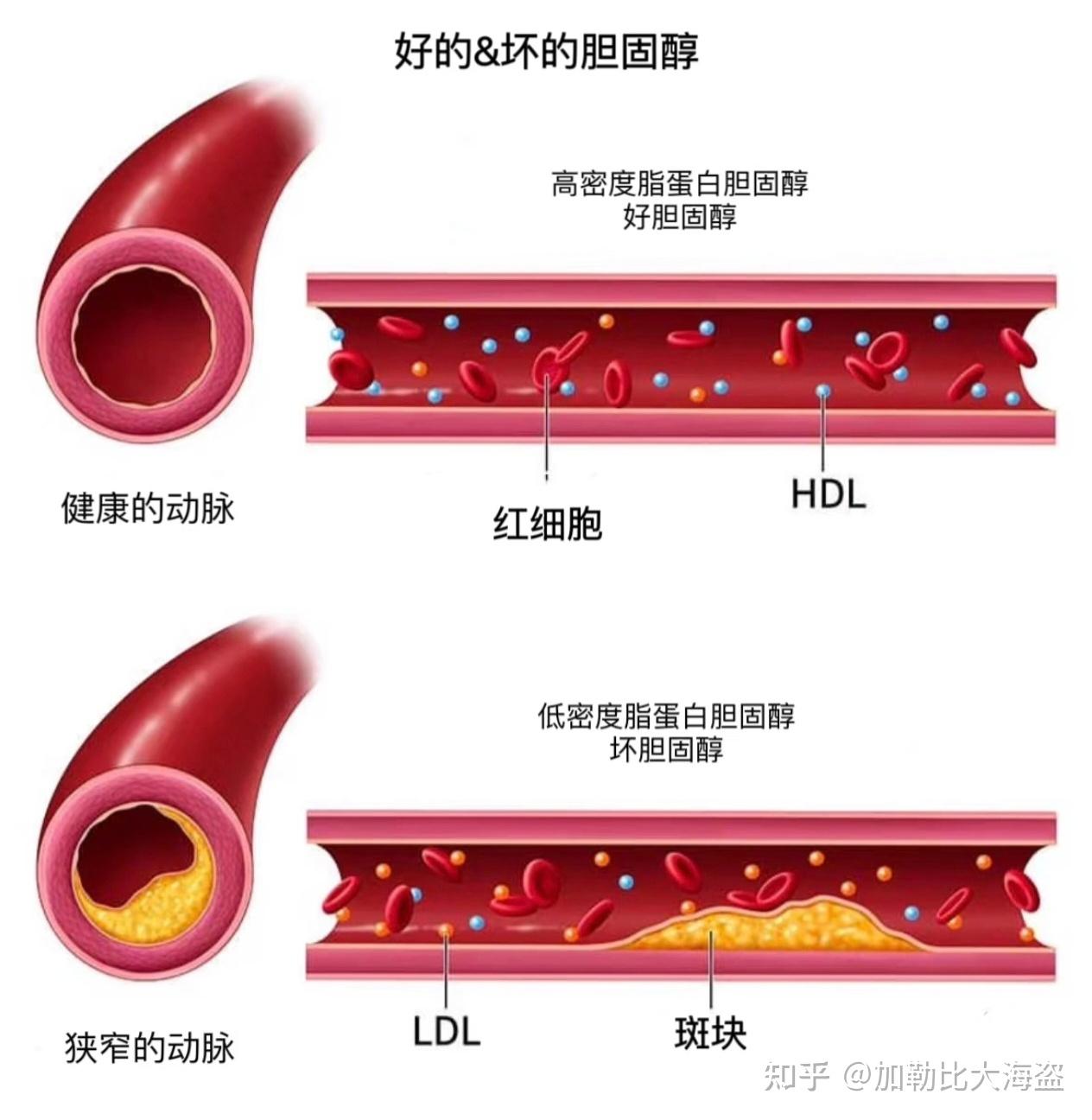 身体素质太差，怎么改善？