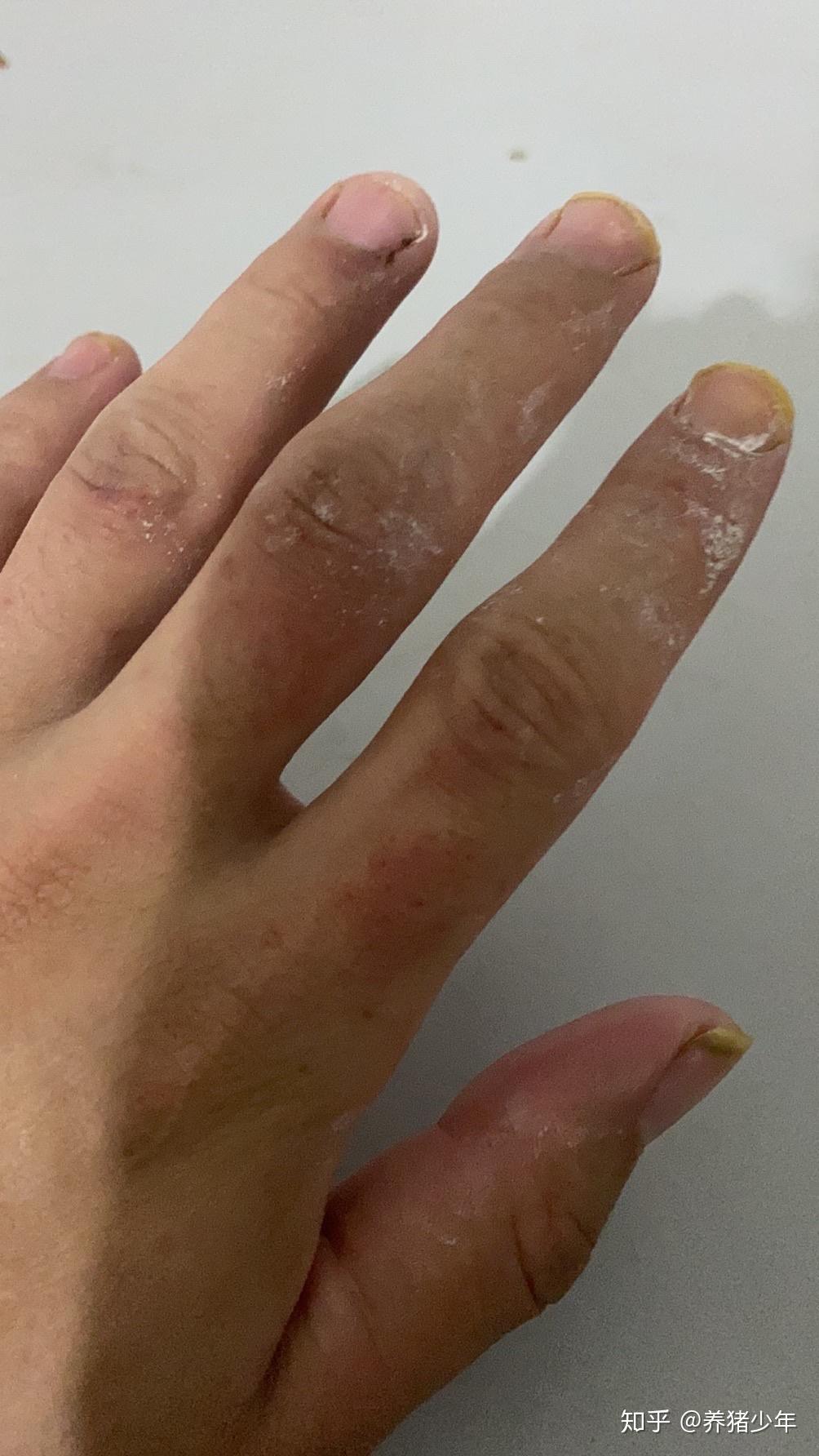 见谅,过几天手好