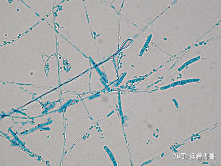 脚气真菌显微镜图图图片