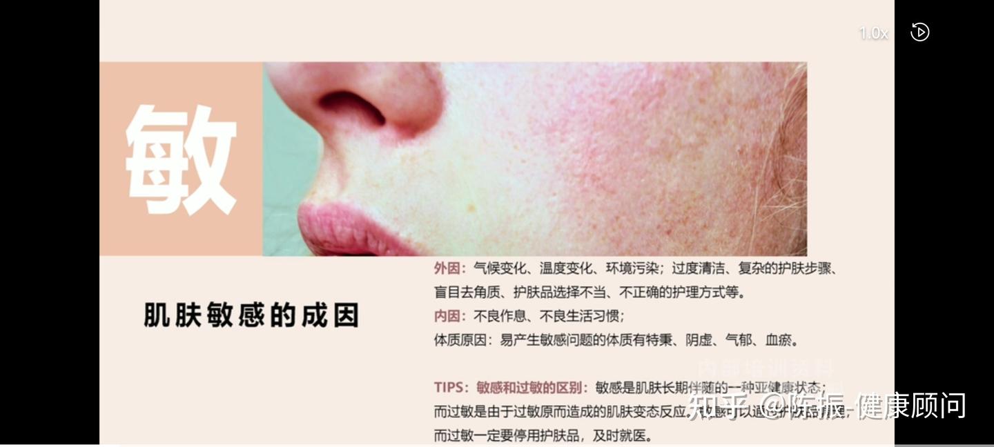 皮肤敏感的原因- 知乎