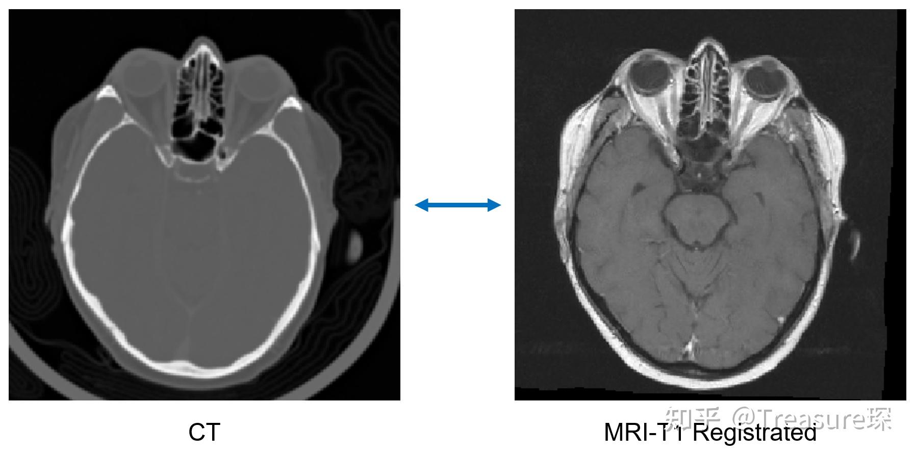 Python ANTs python-ants