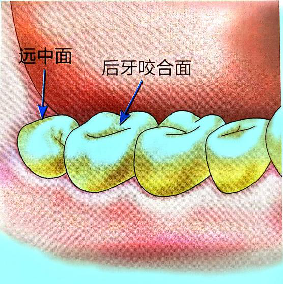 为什么长期刷牙牙齿还很黄